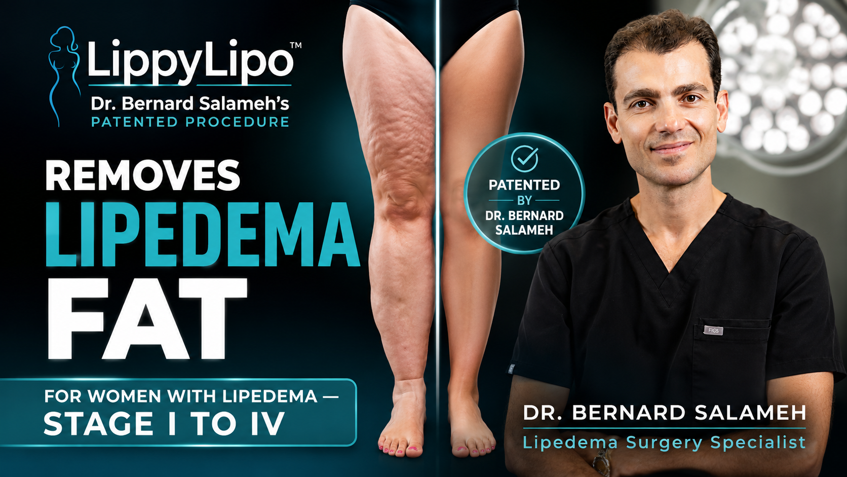 LippyLipo video thumbnail
